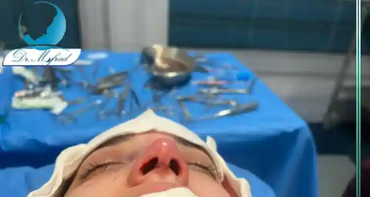 عمل بینی برای بیماران ام اس_ آیا این جراحی می_تواند بی_خطر باشد؟