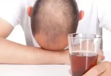 اعتیاد و ریزش مو