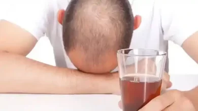 اعتیاد و ریزش مو