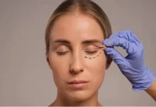 چشم ها را میتوان یکی از تأثیرگذارترین بخش های چهره دانست؛ بخشی که احساسات، خستگی، شادابی و حتی سن ظاهری فرد را به نمایش میگذارد. گاهی افتادگی پوست پلک، پف زیر چشم یا تجمع پوست و چربی در اطراف چشم باعث میشود چهره خسته تر و مسن تر از سن واقعی به نظر برسد.