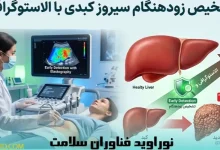 تشخیص زودهنگام سیروز کبدی با الاستوگرافی؛ پیشگیری قبل از رسیدن به نقطه بی‌بازگشت