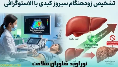 تشخیص زودهنگام سیروز کبدی با الاستوگرافی؛ پیشگیری قبل از رسیدن به نقطه بی‌بازگشت