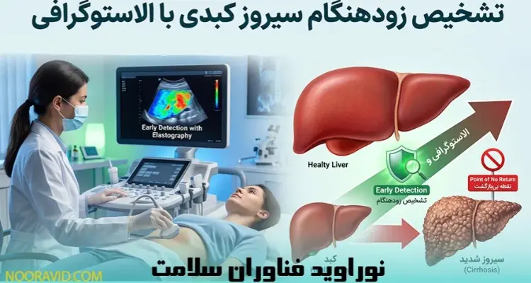 تشخیص زودهنگام سیروز کبدی با الاستوگرافی؛ پیشگیری قبل از رسیدن به نقطه بیبازگشت