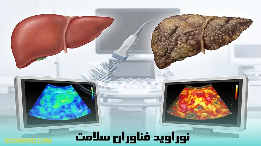 مقایسه کبد سالم و سیروز کبدی در اسکن الاستوگرافی
